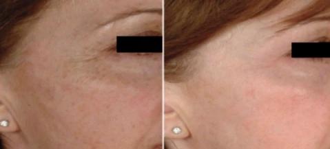Mabox Vitamin C Serum; Mabox 2.5% Retinol Moisturizer Face Cream [Buy Package Save MORE]
