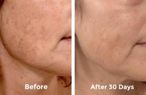 Mabox Vitamin C Serum; Mabox 2.5% Retinol Moisturizer Face Cream [Buy Package Save MORE]