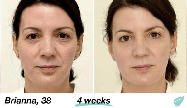 Mabox Vitamin C Serum; Mabox 2.5% Retinol Moisturizer Face Cream [Buy Package Save MORE]