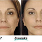Mabox Vitamin C Serum; Mabox 2.5% Retinol Moisturizer Face Cream [Buy Package Save MORE]