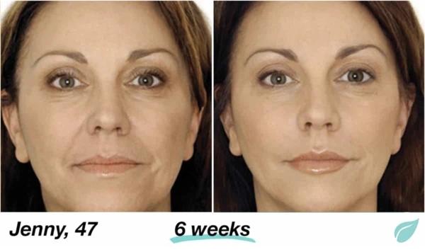 Mabox Vitamin C Serum; Mabox 2.5% Retinol Moisturizer Face Cream [Buy Package Save MORE]