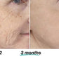 Mabox Vitamin C Serum; Mabox 2.5% Retinol Moisturizer Face Cream [Buy Package Save MORE]