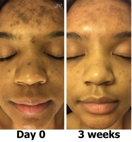 Mabox Vitamin C Serum; Mabox 2.5% Retinol Moisturizer Face Cream [Buy Package Save MORE]